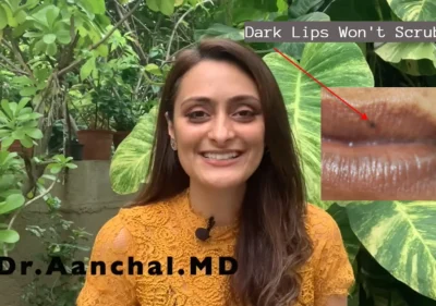 Dark Lips Won't Scrub Off, Here's What Actually Works