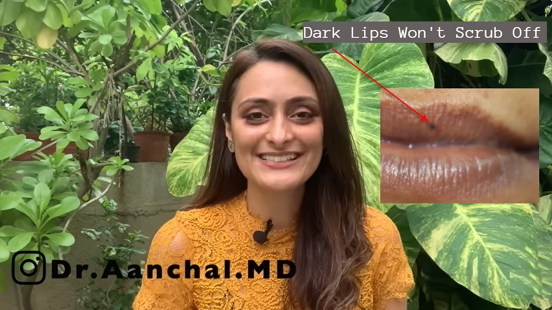 Dark Lips Won't Scrub Off, Here's What Actually Works